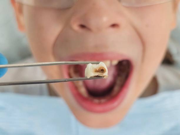 Best Knocked-Out Tooth Emergency  in Munsey Park, NY