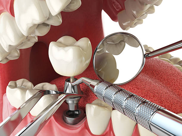 Best Emergency Tooth Extraction  in Munsey Park, NY